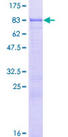 12.5% SDS-PAGE Stained with Coomassie Blue.